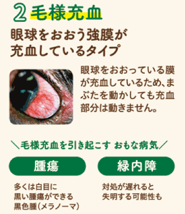 2毛様充血　眼球をおおう強膜が充血しているタイプ　眼球をおおっている膜が充血しているため、まぶたを動かしても充血部分は動きません。　毛様充血を引き起こすおもな病気　腫瘍　多くは白目に黒い腫瘍ができる。黒色腫(メラノーマ)　綠内障対処が遅れると失明する可能性も